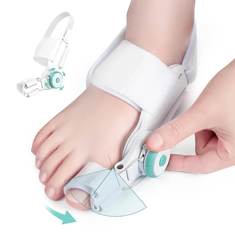 OignonFix™ -  Correcteur efficace pour l'hallux valgus