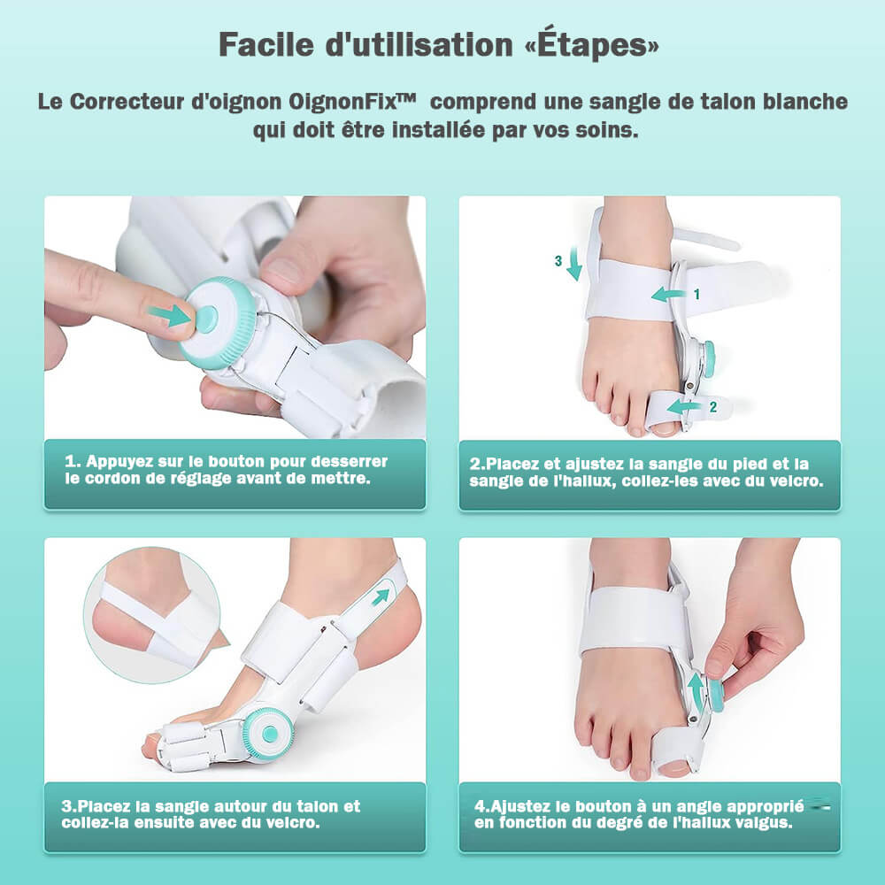 OignonFix™ -  Correcteur efficace pour l'hallux valgus